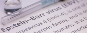 Epstein-Barr - vírus inocente, doença perigosa!